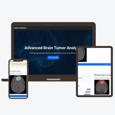 Brain Tumor Detection